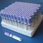 EDTA TUBE Purple cap, EDTA K3 ﻿