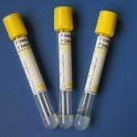Yellow cap, Separate gel & clot activator tube